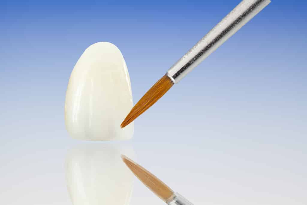 Cosmetic Bonding-Contouring